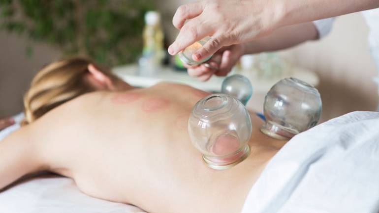 Deep Tissue with Cupping